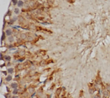 POLL antibody|POLL抗体