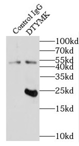 DACH1 antibody|DACH1抗体
