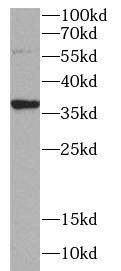 STX7 antibody|STX7抗体