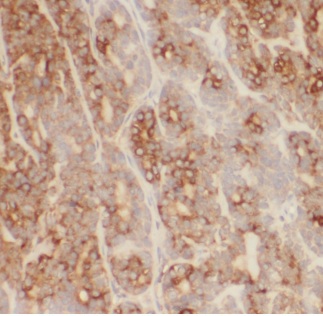 CTNNA3 antibody|CTNNA3抗体