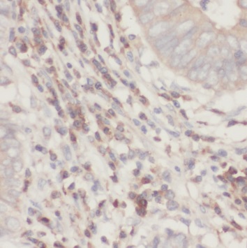 TRIM31 antibody|TRIM31抗体