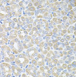 SKAP2 antibody|SKAP2抗体