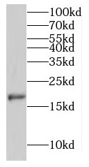 MPHOSPH6 antibody|MPHOSPH6抗体