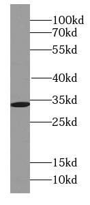 SLC25A6-Specific antibody|SLC2