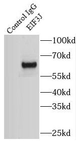 DHX36 antibody|DHX36抗体