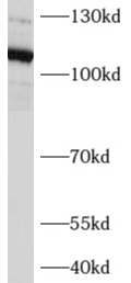 AFAP1L2 antibody|AFAP1L2抗体