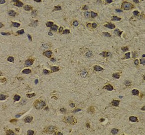 OGG1 antibody|OGG1抗体