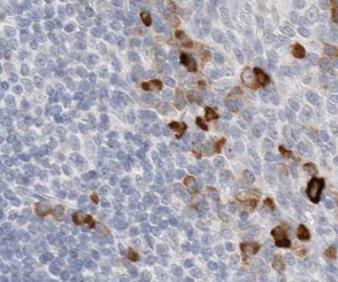 ACKR2 antibody|ACKR2抗体