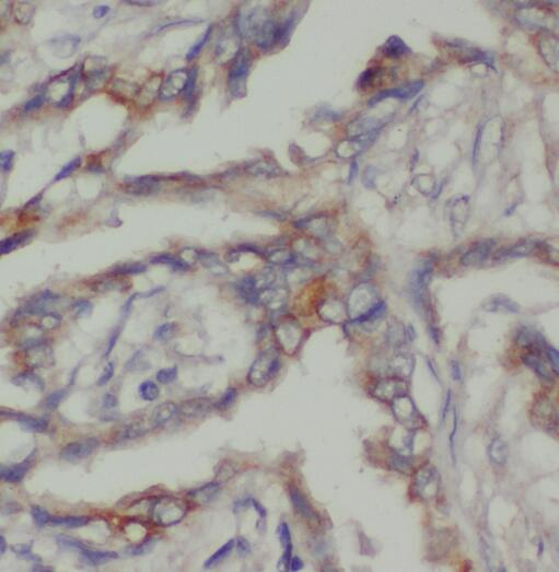 PBXIP1 antibody|PBXIP1抗体