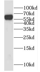 HYAL2 antibody|HYAL2抗体 FNab040