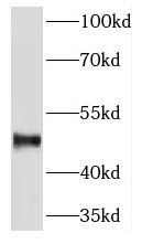 PLIN3 antibody|PLIN3抗体