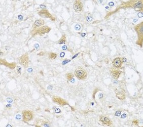 APOL1 antibody|APOL1抗体 FNab005