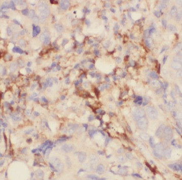 PIP antibody|PIP抗体