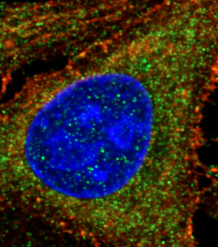 RAB11A antibody|RAB11A抗体