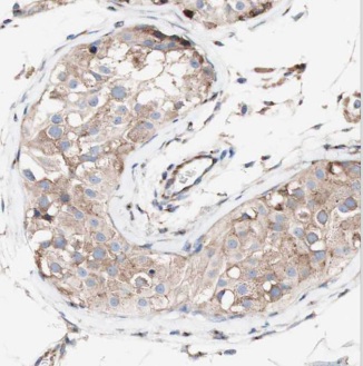 CRISP2 antibody|CRISP2抗体