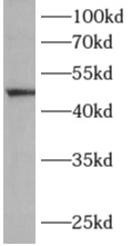 ALG1 antibody|ALG1抗体