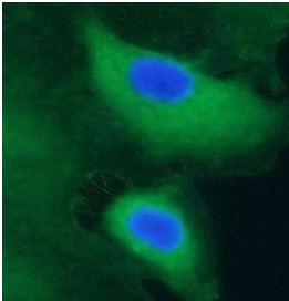 CBLIF antibody|CBLIF抗体 FNab101