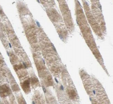 SLC25A6-Specific antibody|SLC2