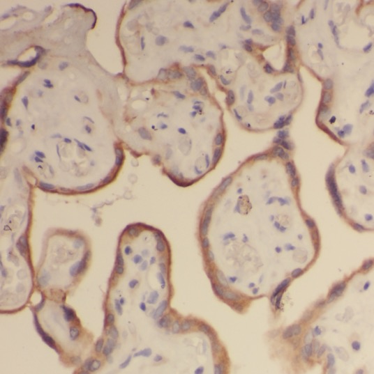 SMAD4 antibody|SMAD4抗体 FNab079