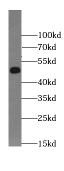 CELF5 antibody|CELF5抗体