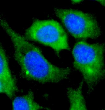 TRIM37 antibody|TRIM37抗体