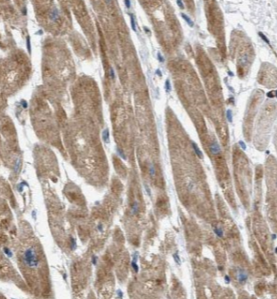 ADGRB2-Specific antibody|ADGRB