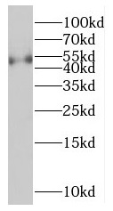 PPM1F antibody|PPM1F抗体