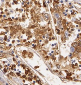 XBP1 antibody|XBP1抗体