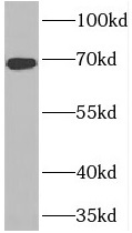 FNBP1L antibody|FNBP1L抗体