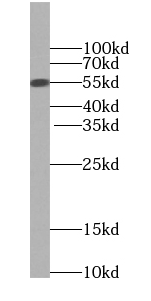 TINAG antibody|TINAG抗体