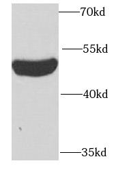 PSTPIP1 antibody|PSTPIP1抗体