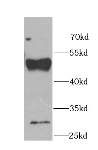 FDFT1 antibody|FDFT1抗体