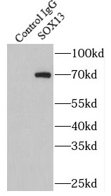 AKAP17A antibody|AKAP17A抗体