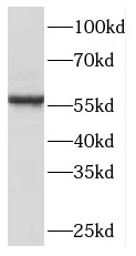 PHGDH antibody|PHGDH抗体