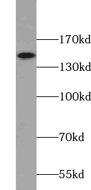 VPS8 antibody|VPS8抗体