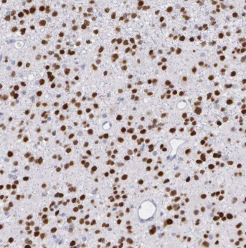 PMP2 antibody|PMP2抗体