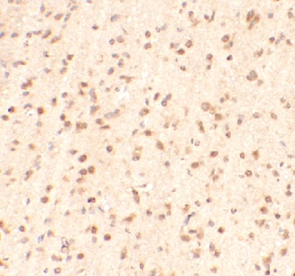 METTL14 antibody|METTL14抗体