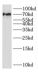 IGSF8 antibody|IGSF8抗体