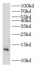 RPL30 antibody|RPL30抗体