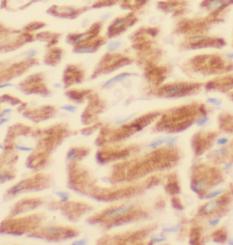 LDHA-Specific antibody|LDHA抗体