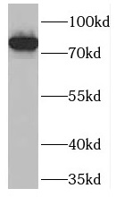 PCIF1 antibody|PCIF1抗体