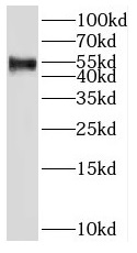 SH2D4A antibody|SH2D4A抗体