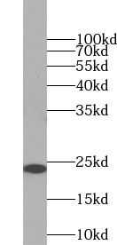 RAB5A antibody|RAB5A抗体