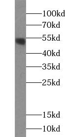 ACOT2 antibody|ACOT2抗体