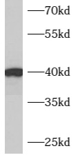 ARMCX3 antibody|ARMCX3抗体