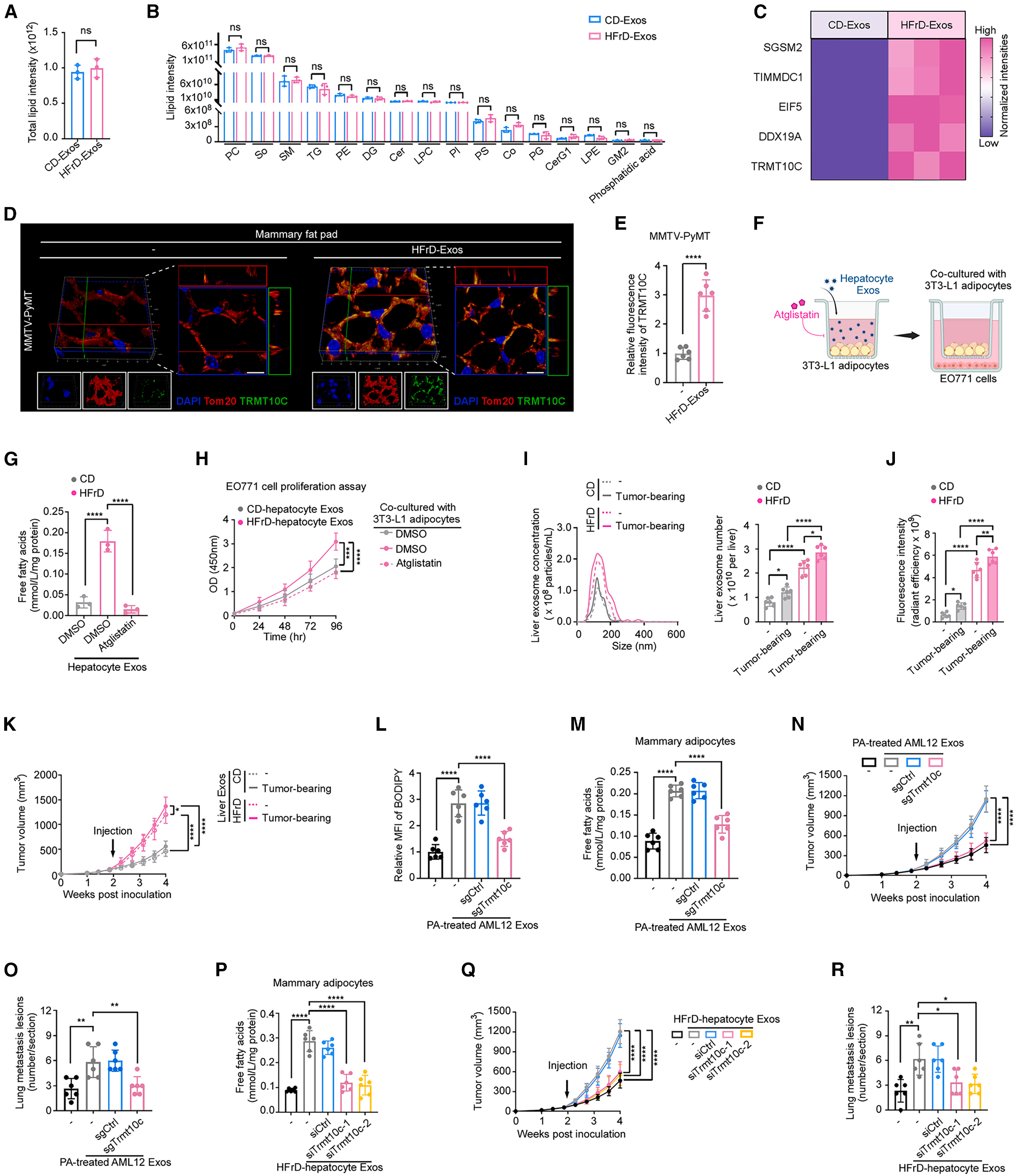 Cell Metabolism | 脂肪肝竟是乳腺癌的“远程指挥官”？科学家揭秘它的致癌信使