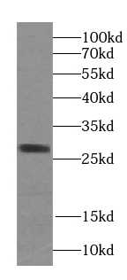 STARD3NL antibody|STARD3NL抗体