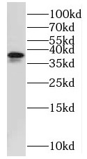MRPS31 antibody|MRPS31抗体