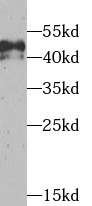 TEAD1 antibody|TEAD1抗体 FNab085