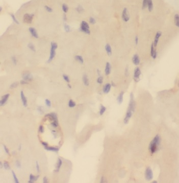 NUDT9 antibody|NUDT9抗体